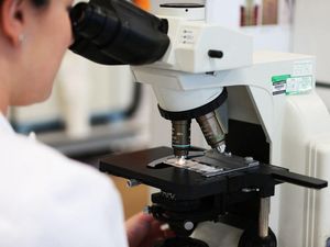 Supporting image for story: Memory creation in ageing brains could be restored by lifting ‘brake pad’