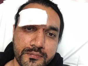 Supporting image for story: 'This guy was like an animal': Go Carz taxi driver beaten in suspected racist attack