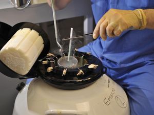 Supporting image for story: Storage limit for frozen eggs, sperm and embryos to be increased to 55 years