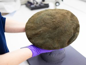 Person in protective gloves holding a knitted bonnet