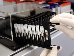 Supporting image for story: Foot-and-mouth disease virus could help target deadly pancreatic cancer – study