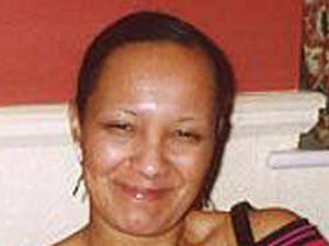 Supporting image for story: Attacked woman fighting for life