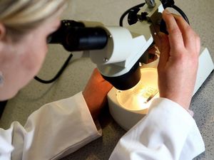 Supporting image for story: Parkinson’s disease may start before birth, study suggests