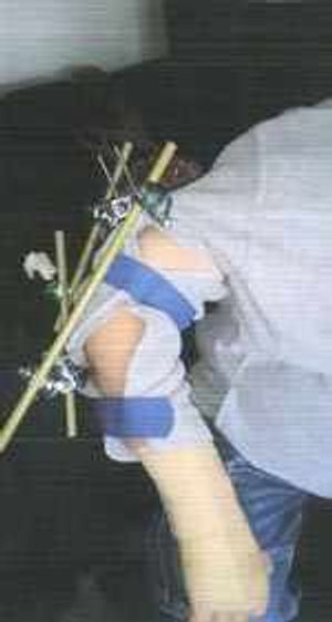 Mark Lawrence Ryan's arm is currently pinned