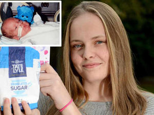 Supporting image for story: She was born just 1lb 7oz, but just look at 'sugar bag baby' Jess now