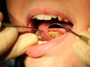 Supporting image for story: Star comment: Tooth choices facing our kids