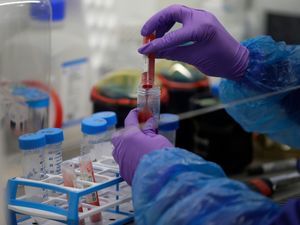 Supporting image for story: One Brazilian coronavirus variant detected in UK before travel ban – virologist