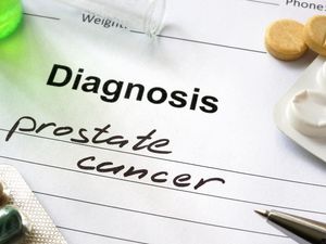 Supporting image for story: Scientists block growth signal in prostate cancer cells