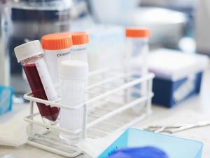 Supporting image for story: New cancer tests could lead to more clinical trials, say scientists