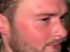 Supporting image for story: Appeal after man assaulted and left with broken jaw in Wolverhampton