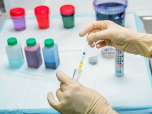 Supporting image for story: AI urine analysis predicts infection in lung disease patients a week in advance