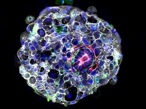 Supporting image for story: Scientists discover clue which could explain why early pregnancies fail