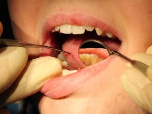 Supporting image for story: NHS dentistry ‘at tipping point’ with warning that patients will ‘pay the price’