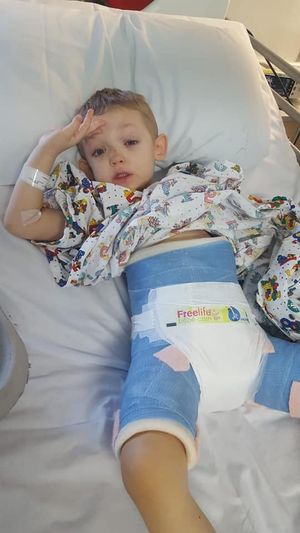 Kyle suffered extensive injuries following the crash