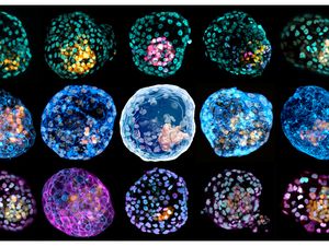 Supporting image for story: Scientists create model of early human embryo from skin cells – study