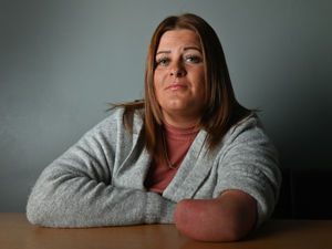 Supporting image for story: Wolverhampton woman raising money for bionic arm after arthritis diagnosis in other hand