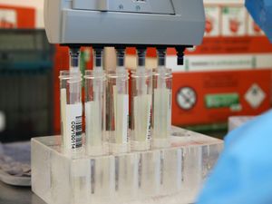 Supporting image for story: No further coronavirus deaths in Shropshire but UK toll grows by 14