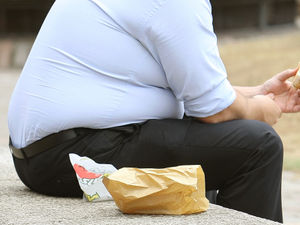 Supporting image for story: What is making us so fat?