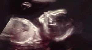 The all important scan