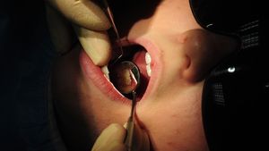 Supporting image for story