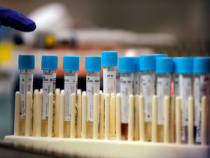 Supporting image for story: Coronavirus testing kits to be delivered to homes in Oldbury and Tipton after variant discovered