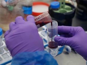 Supporting image for story: Cheap steroid trialled in Shropshire hospitals dramatically reduces Covid-19 deaths 