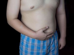 Supporting image for story: One in 10 children in first year of primary school in England is obese
