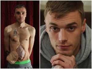 Supporting image for story: "It is horrible to think that whoever did this is still out there" - Victim recalls shotgun blast one year on