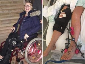 Pc Claire Bond in a wheelchair, left, and in hospital, right