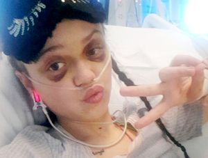 Bobbie Goodman recovers in hospital, after being thrown from a tower block window of Merton House in Chelmsley Wood