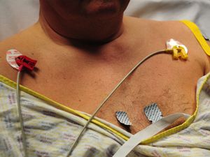 Supporting image for story: Labour and Lib Dems unveil rival plans to cut cancer waiting lists