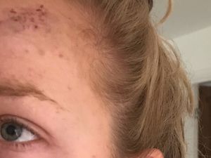 Supporting image for story: Teenager arrested over attack on jogger near Stafford