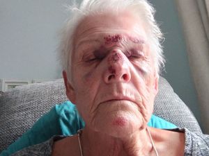 Supporting image for story: Telford woman spends 15 hours in A&E after suffering broken nose in car park fall