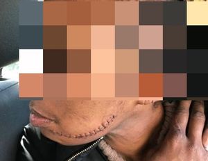 One of Layne's victims needed 42 stitches following the knife attack