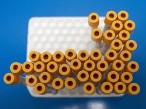 Supporting image for story: Three-quarters of adults have Covid-19 antibodies, data suggests