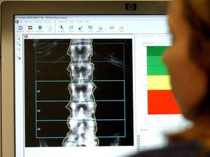 Supporting image for story: Vitamin D supplements in pregnancy shown to improve bone density in childhood