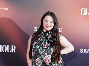 Supporting image for story: Model Ellie Goldstein announced as latest celebrity for Strictly Come Dancing