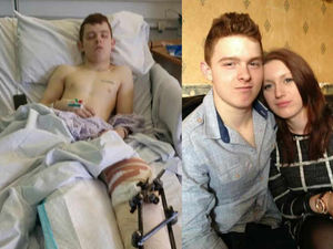 Supporting image for story: Hit-and-run victim, aged 21: Driver left me screaming for help in road