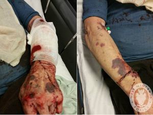 Supporting image for story: Robber attacks 75-year-old man with iron bar