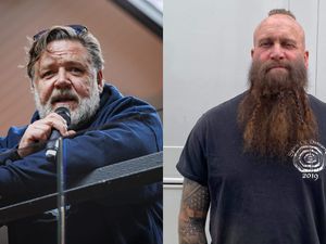 Supporting image for story: Actor hits £25k goal for leg treatment with help from friend Russell Crowe