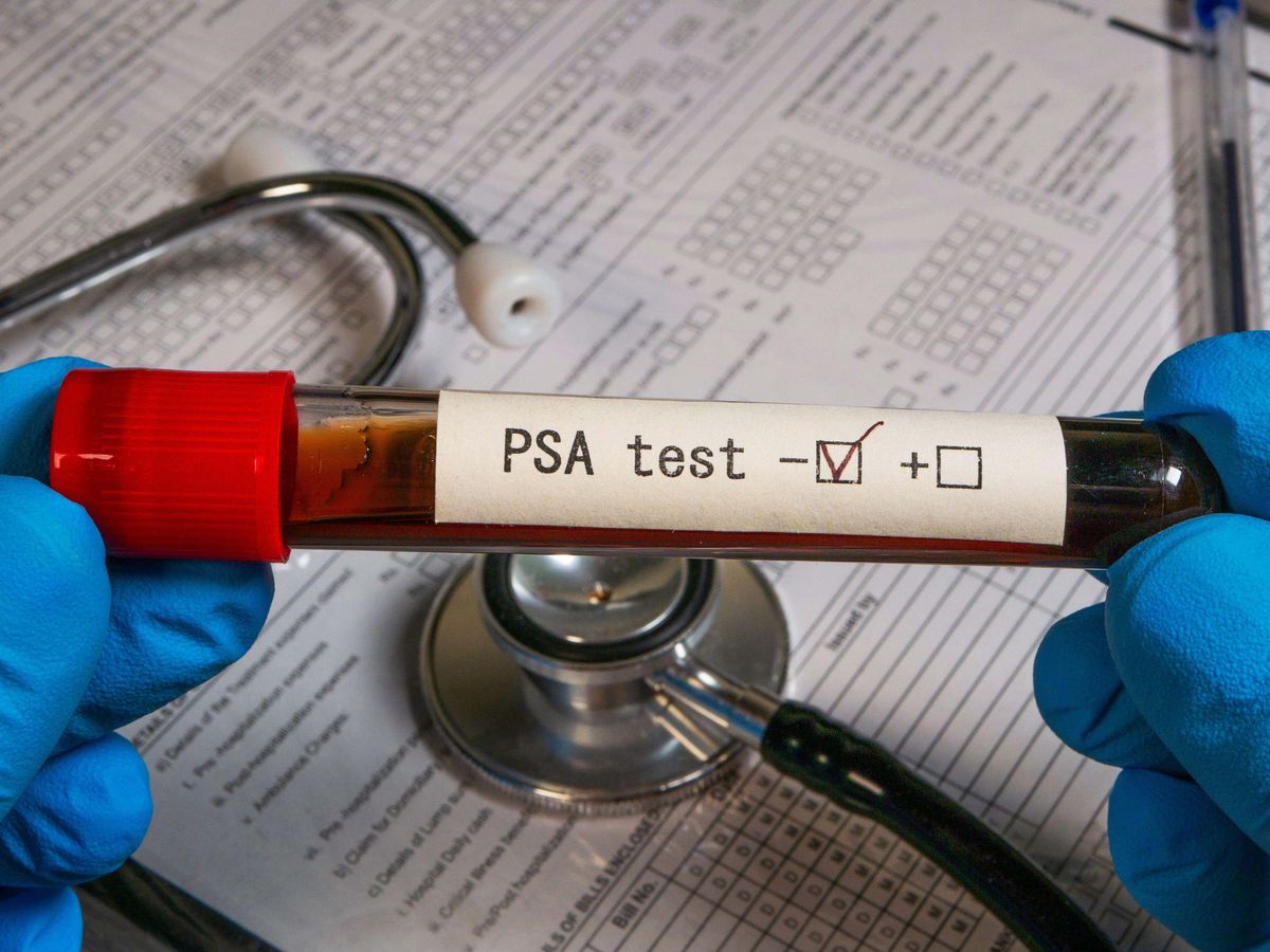 Trial for prostate cancer treatment with fewer side effects launches in UK