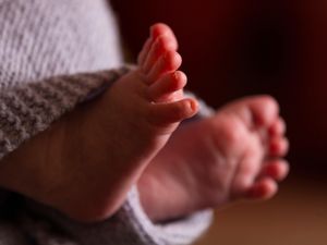Supporting image for story: Study: Brain haemorrhage treatment cuts long-term disability in premature babies