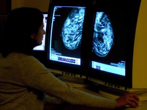 Supporting image for story: Shortage of mammographers ‘could put women at risk’ – experts