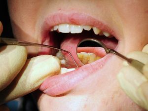 Supporting image for story: Bupa Dental Care to cut 85 practices in a move affecting 1,200 staff