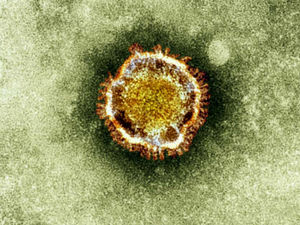 Supporting image for story: Express & Star comment: Covid has changed our perspective