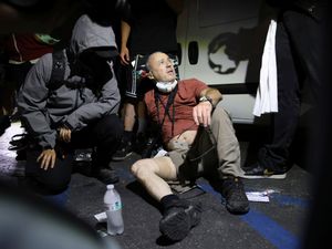 Supporting image for story: British photographer hit by non-lethal bullets during LA protests