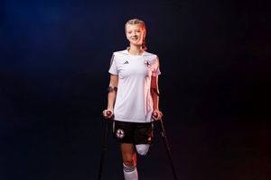 Annabel Kiki is Lioness footballer who lost a leg to cancer aged 13.  