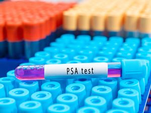 Supporting image for story: Ads for ‘misleading’ prostate supplements and home testing kits banned