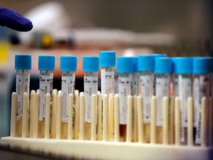 Supporting image for story: No new coronavirus deaths in Black Country, Birmingham or Staffordshire