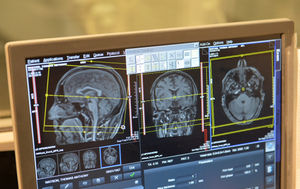 The scan showing Mr Watson's brain